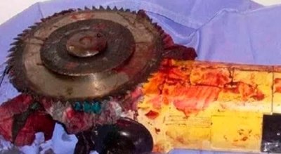 Joven se cortó el cuello accidentalmente con una amoladora - Noticiero Paraguay
