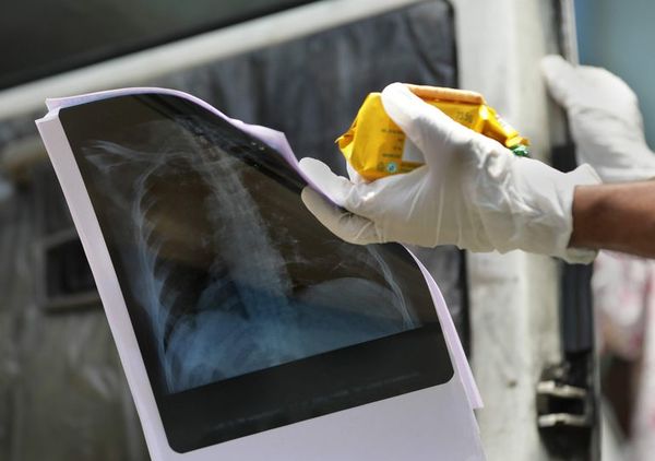 Estudian el anticuerpo monoclonal ‘sotrovimab’ para tratar el covid-19 - Ciencia - ABC Color