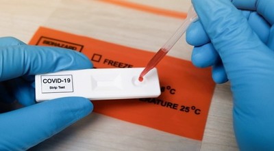 COVID: ANTICUERPOS PERMANECEN EN SANGRE AL MENOS 8 MESES, SEGÚN ESTUDIO