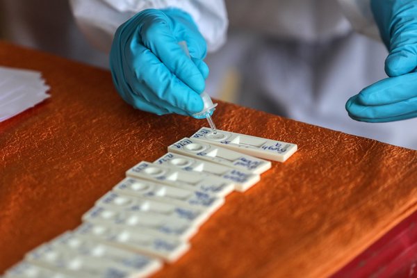 ¿Cómo sé si tuve coronavirus en el pasado?