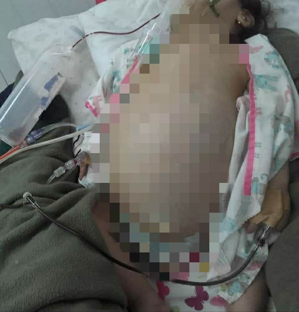 NIÑA NECESITA INTERVENCIÓN QUIRÚRGICA DE SUMA URGENCIA