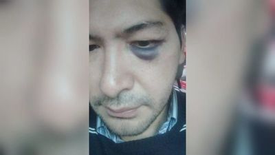 Acusa a precandidato a concejal de Sanlo de reventarle el ojo
