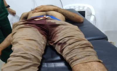 Joven muere desangrado tras sufrir un balazo