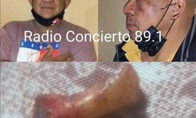Golpeó brutalmente a su padre y hasta le echó un diente