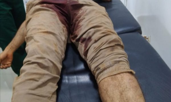 Matan a joven de un balazo en ronda de tragos