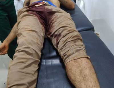 Joven muere tras recibir un balazo en el muslo en un asentamiento de CDE – Diario TNPRESS