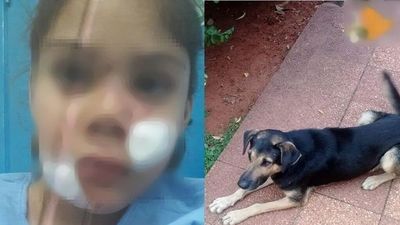 Perro le mordió en la cara a niña de 6 años