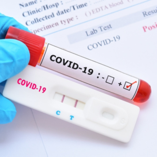 Por la alta circulación del coronavirus, podría surgir otra variante en Sudamérica, advierten | Ñanduti