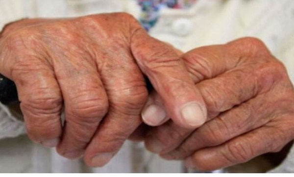 ¡Picarón! Abuelo fallece por consumo excesivo de potenciador sexual