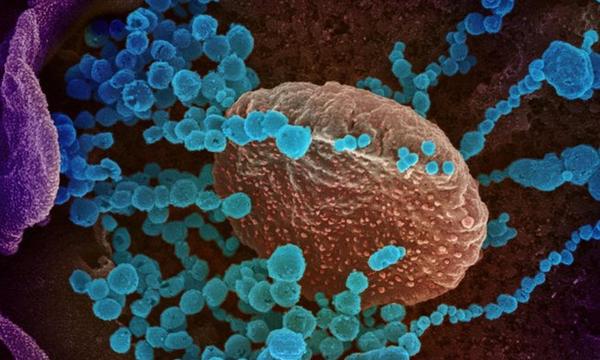 Hallan una nueva forma de transmisión del COVID-19, lo que daría pistas de cómo combatir al virus – Prensa 5