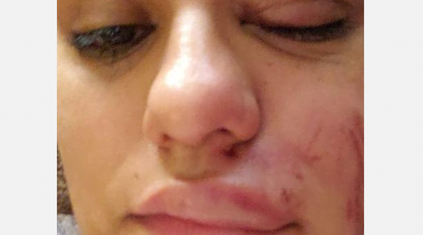 Mujer denunció a hermano de Nenecho por violencia intrafamiliar y la imputan a ella - Noticiero Paraguay