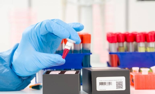 Diario HOY | Brasil realizará test rápidos para frenar expansión de la variante india