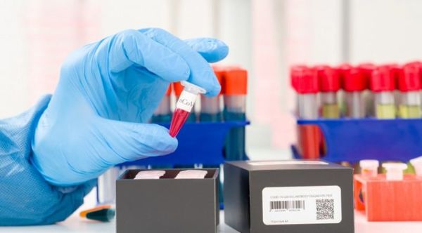 Brasil realizará test rápidos para frenar expansión de la variante india