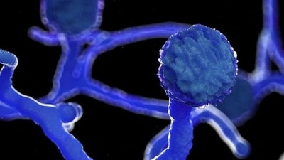 No es ficción: Detecta en la India un peligroso “hongo negro” que afecta a pacientes con Covid-19