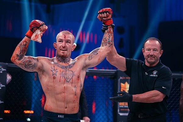 La espeluznante imagen de un luchador de la MMA que recorre el mundo ¡Y no es pintura lo que luce!