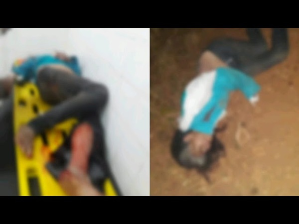 MUJER GRAVEMENTE HERIDA TRAS SER EMBESTIDA POR UN MOTOCICLISTA