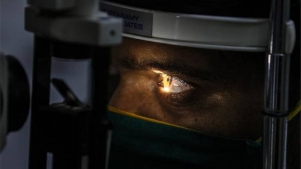 Diario HOY | Hongo negro en India: extirpan ojos a pacientes con Covid para salvarlos