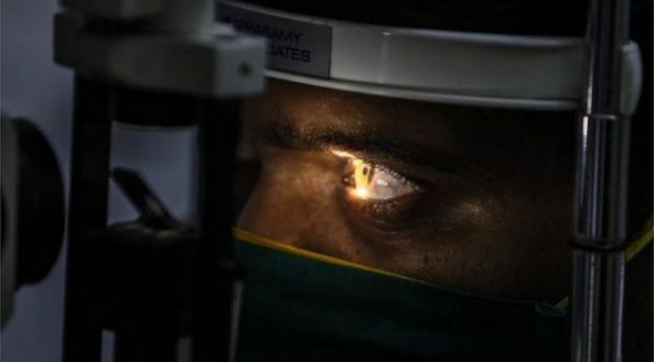 Hongo negro en India: extirpan ojos a pacientes con Covid para salvarlos