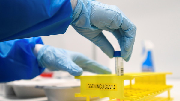 Científicos descubrieron que la inmunidad al coronavirus podría durar años | .::Agencia IP::.