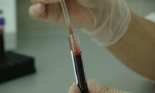 ¿Sabías que cada 35 segundos alguien es diagnosticado con cáncer en la sangre?