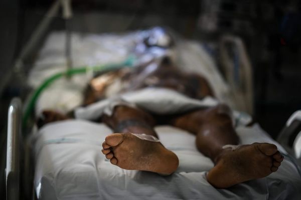 La pandemia solo terminará “cuando el 70% de la población esté vacunada” - Mundo - ABC Color