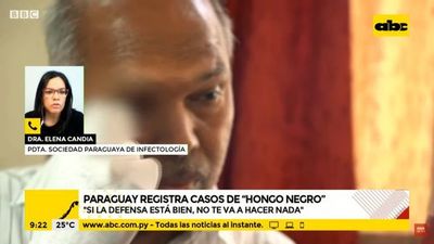 Al “hongo negro” lo conocemos hace más de 20 años, dice infectóloga - A la gran 730 - ABC Color