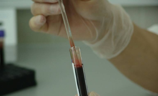 Diario HOY | Cada 35 segundos alguien en el mundo es diagnosticado con cáncer en la sangre