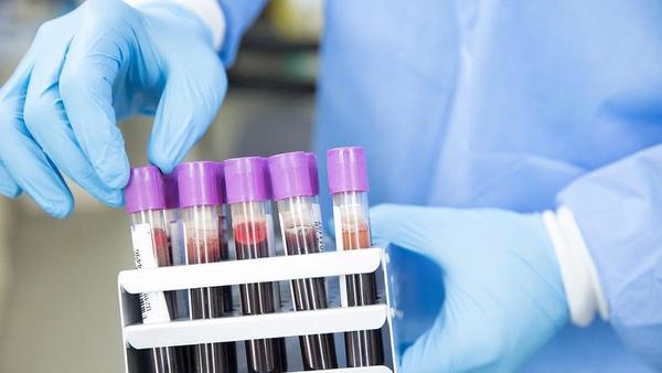 En el mundo cada 35 segundos alguien es diagnosticado con cáncer en la sangre – Prensa 5