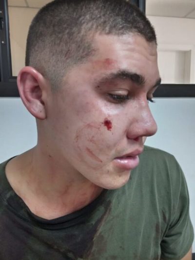 MRA: Militar es herido en extrañas circunstancias aparentemente por su camarada | Ñanduti
