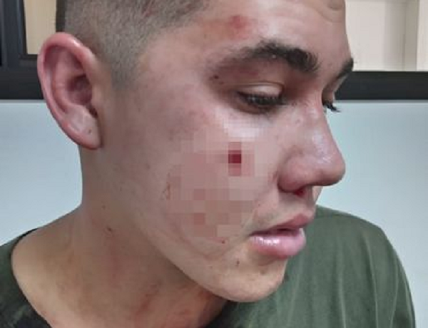Militar citó a su camarada a su casa y lo recibió con un disparo en la cara - Noticiero Paraguay
