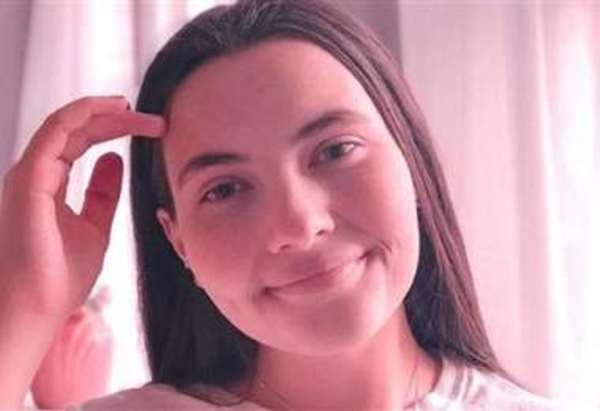 Alergia al agua: joven relata cómo reacciona su cuerpo a las lágrimas y el sudor