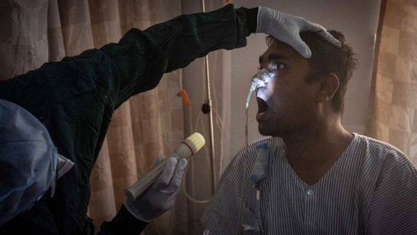 Hongo Negro: seis claves sobre la rara infección que ataca a pacientes de covid-19 | OnLivePy