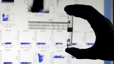 Un nuevo test que logra detectar anticuerpos del Covid-19 hasta hoy invisibles