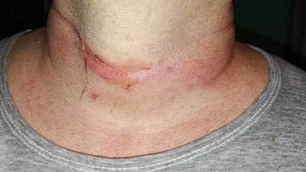 Motociclista casi murió en trampa de bandidos
