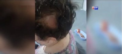 Sexagenaria fue brutalmente agredida por delincuente | Noticias Paraguay