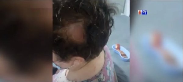 Sexagenaria fue brutalmente agredida por delincuente | Noticias Paraguay