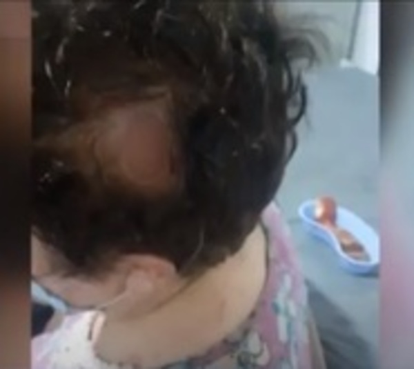 Cobarde agresión a sexagenaria por parte de ladrón - Paraguay.com