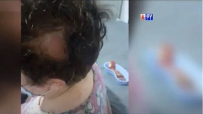 Ladrón le reventó la cabeza a doña para robarle