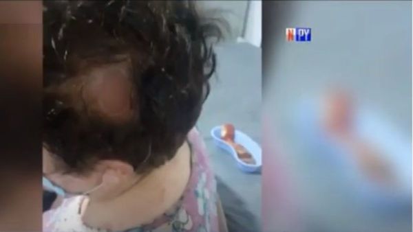 Ladrón le reventó la cabeza a doña para robarle