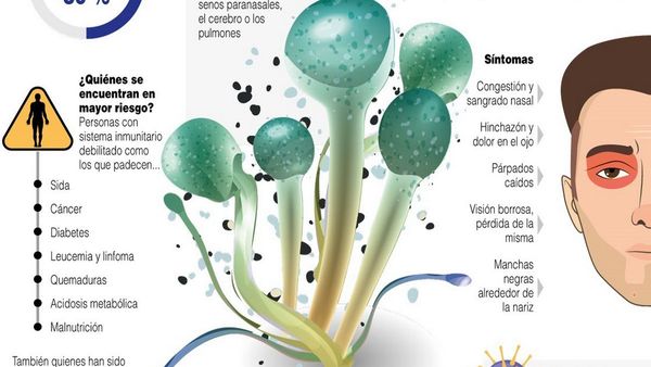 El hongo negro, infección con alta incidencia en pacientes con Covid