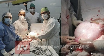 EXTIRPARON UN TUMOR 5,6 KG EN EL HOSPITAL DE NATALIO.