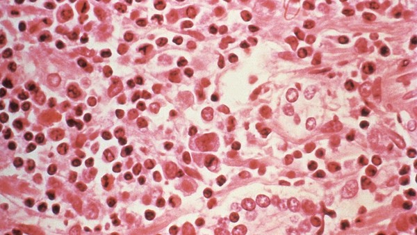 EE.UU.: Detectan un primer caso humano de hantavirus en el estado de Míchigan - ADN Digital