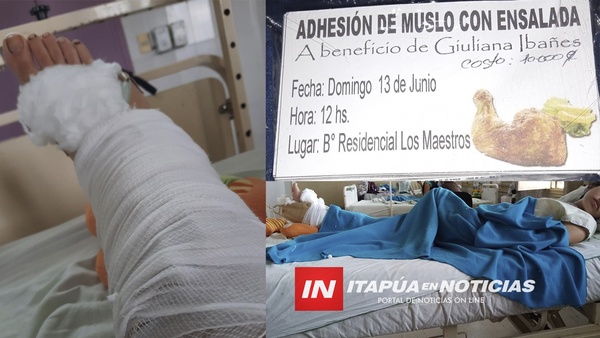 GIULIANA NECESITA AYUDA TRAS SOBREVIVIR AL ACCIDENTE, DONDE FALLECIERON SU MADRE Y SU HERMANITO