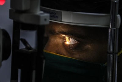 La India registra un aumento del 150 % en las infecciones por ‘hongo negro’ | Ñanduti