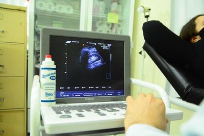 Anuncian servicio gratuito de electrocardiograma en laboratorio municipal de Ciudad del Este - ABC en el Este - ABC Color