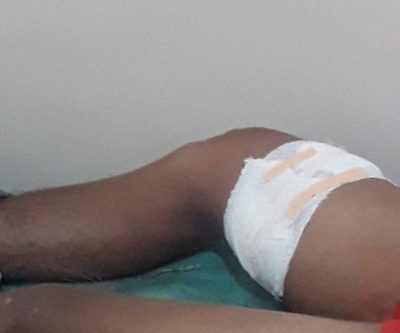Menor herido tras disparo accidental por parte de un amigo