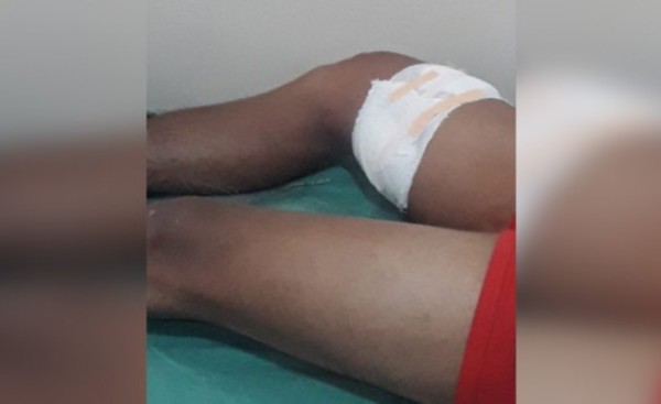 Disparó a su amigo accidentalmente cuando manipulaban un arma de fuego