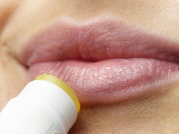 Las llagas o “fuegos” recurrentes podrían indicar una patología neoplásica - Estilo de vida - ABC Color