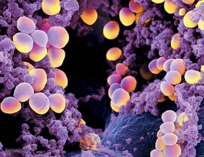 Advierten que en hospitales hay múltiples casos de pacientes con “bacterias multirresistentes a antibióticos” - ADN Digital