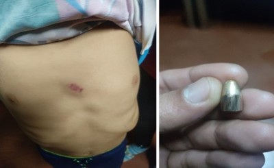 Bala perdida cae sobre el pecho de niño dormido